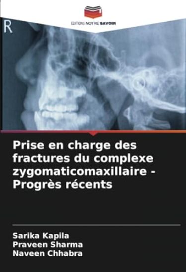 Prise en charge des fractures du complexe zygomaticomaxillaire - Progrès récents