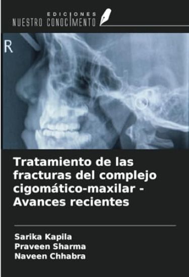 Tratamiento de las fracturas del complejo cigomático-maxilar - Avances recientes