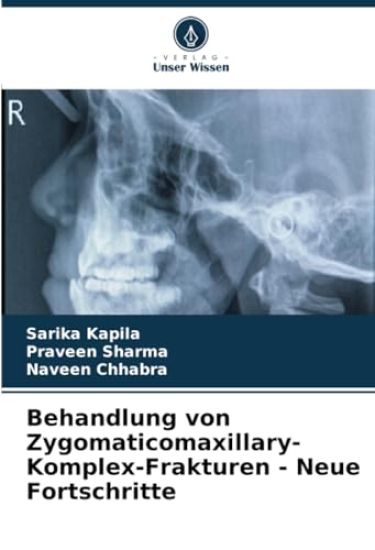 Behandlung von Zygomaticomaxillary-Komplex-Frakturen - Neue Fortschritte
