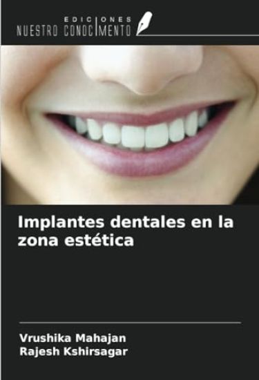 Implantes dentales en la zona estética