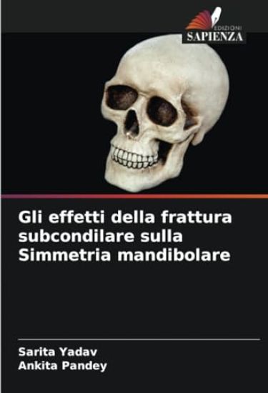 Gli effetti della frattura subcondilare sulla Simmetria mandibolare – Sarita Yadav, kirjan kansikuva