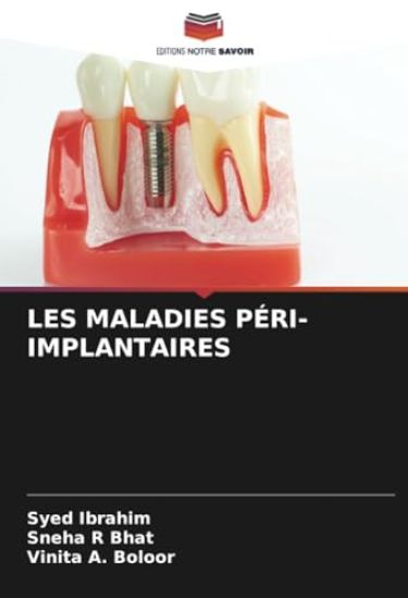Les Maladies Péri-Implantaires