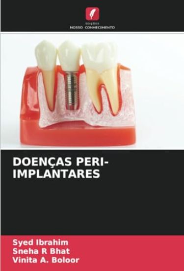 Doenças Peri-Implantares