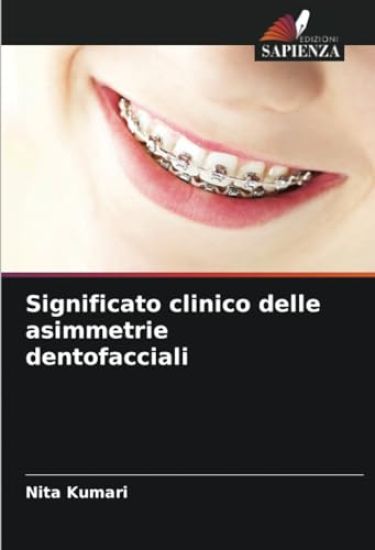 Significato clinico delle asimmetrie dentofacciali