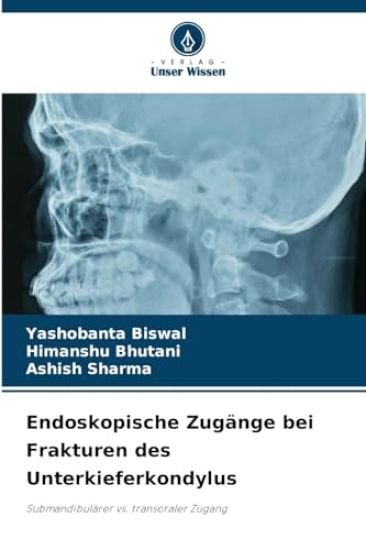 Endoskopische Zugänge bei Frakturen des Unterkieferkondylus