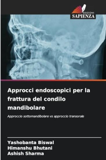 Approcci endoscopici per la frattura del condilo mandibolare