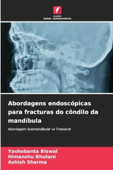 Abordagens endoscópicas para fracturas do côndilo da mandíbula