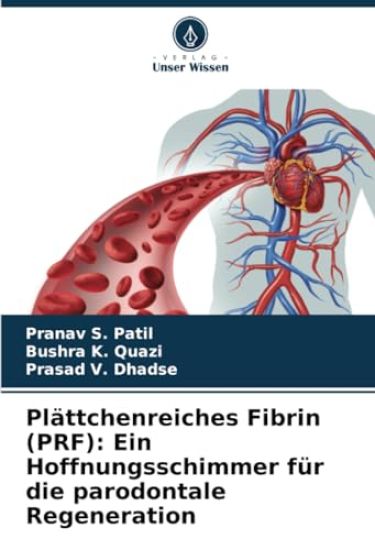 Plättchenreiches Fibrin (PRF)