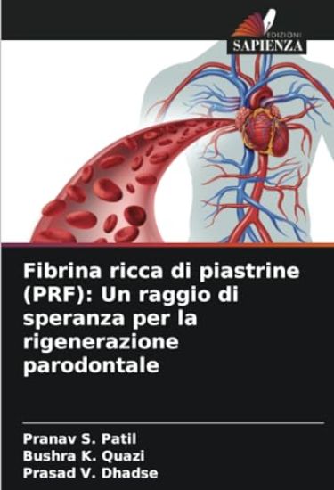 Fibrina ricca di piastrine (PRF)
