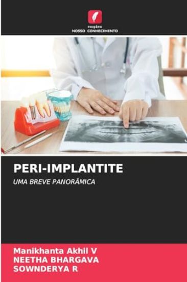 Peri-Implantite