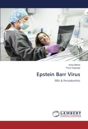 Epstein Barr Virus