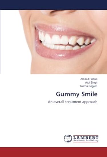 Gummy Smile