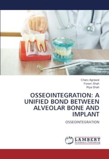 OSSEOINTEGRATION: A UNIFIED BOND BETWEEN ALVEOLAR BONE AND IMPLANT