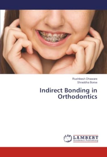 Indirect Bonding in Orthodontics