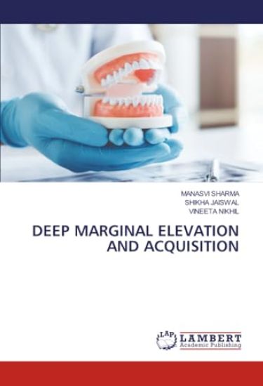 Deep Marginal Elevation and Acquisition