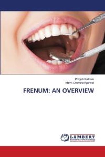 Frenum