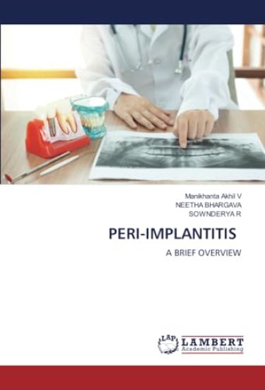 Peri-Implantitis
