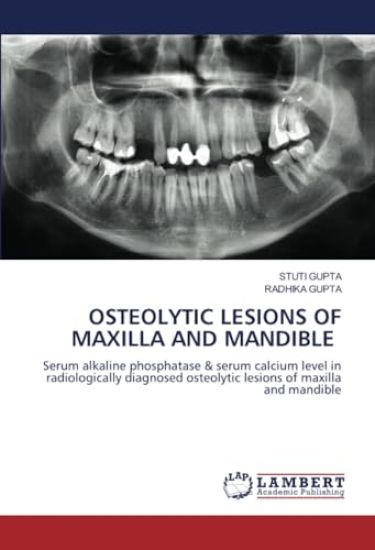 Osteolytic Lesions of Maxilla and Mandible