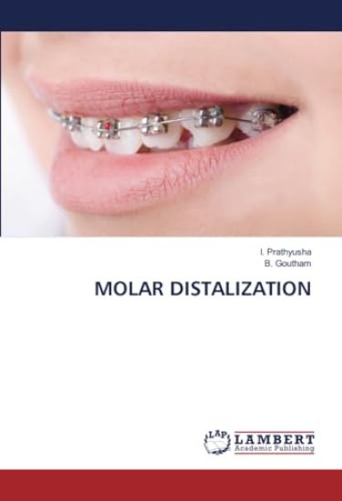 Molar Distalization