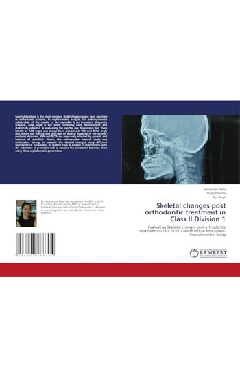 Skeletal changes post orthodontic treatment in Class II Division 1