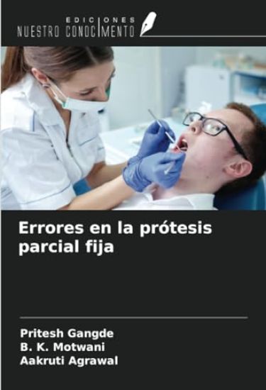 Errores en la prótesis parcial fija