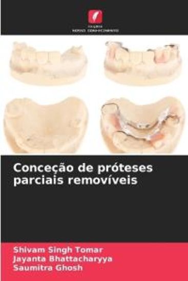 Conceção de próteses parciais removíveis