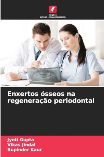 Enxertos ósseos na regeneração periodontal