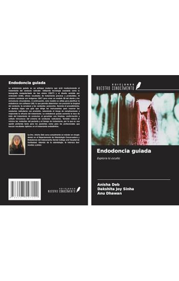 Endodoncia guiada