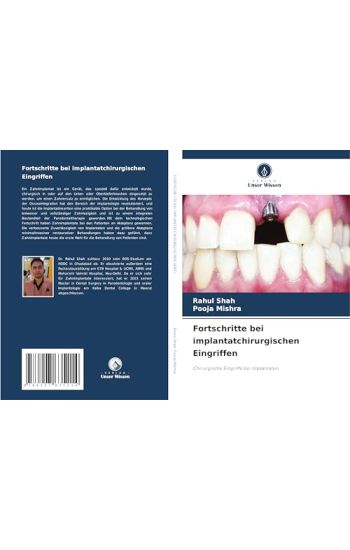 Fortschritte bei implantatchirurgischen Eingriffen