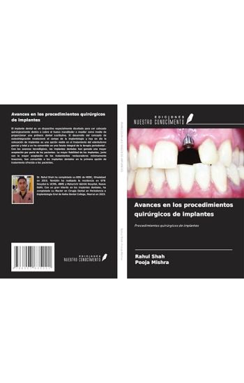 Avances en los procedimientos quirúrgicos de implantes