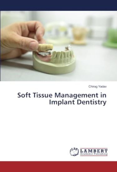 Soft Tissue Management in Implant Dentistry