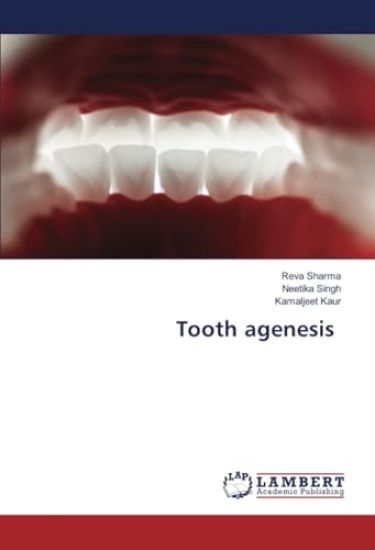Tooth agenesis