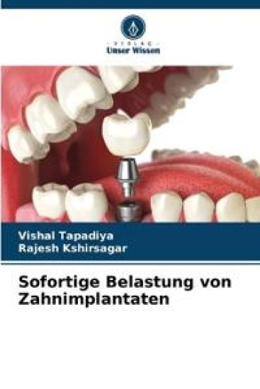 Sofortige Belastung von Zahnimplantaten