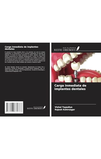 Carga inmediata de implantes dentales