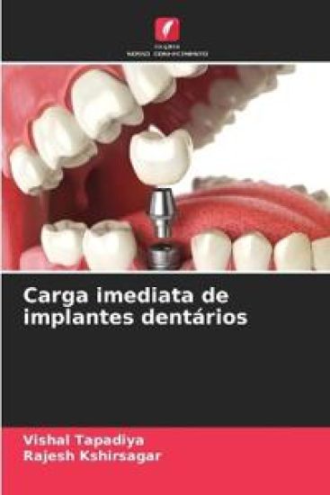 Carga imediata de implantes dentários