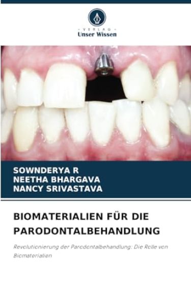 Biomaterialien Für Die Parodontalbehandlung