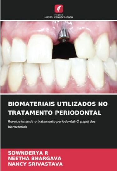 Biomateriais Utilizados No Tratamento Periodontal