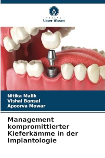 Management kompromittierter Kieferkämme in der Implantologie