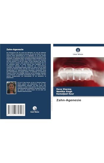 Zahn-Agenesie