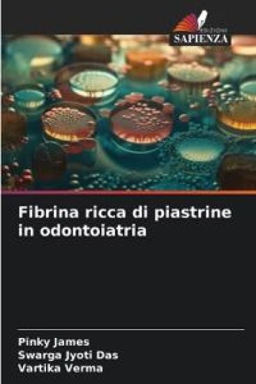 Fibrina ricca di piastrine in odontoiatria