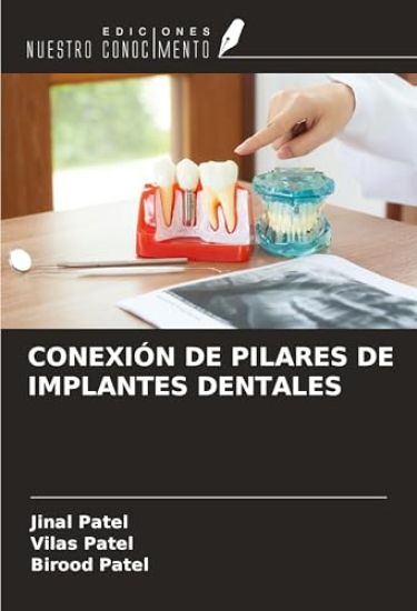 CONEXIÓN DE PILARES DE IMPLANTES DENTALES