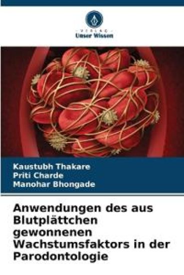 Anwendungen des aus Blutplättchen gewonnenen Wachstumsfaktors in der Parodontologie
