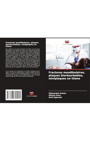Fractures mandibulaires, plaques biorésorbables, miniplaques en titane – Vijayendra Kumar, kirjan kansikuva