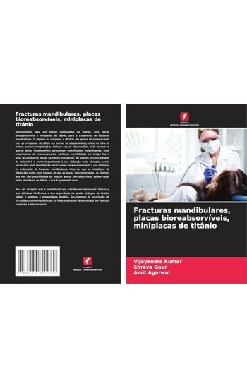 Fracturas mandibulares, placas bioreabsorvíveis, miniplacas de titânio – Vijayendra Kumar, kirjan kansikuva