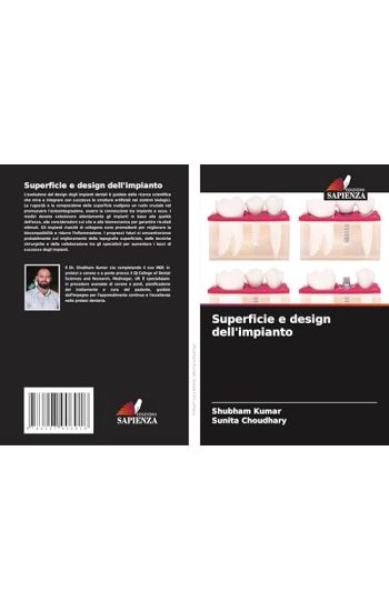 Superficie e design dell'impianto