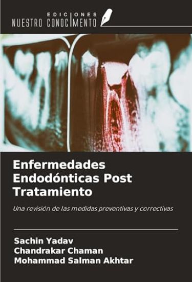 Enfermedades Endodónticas Post Tratamiento – Sachin Yadav, kirjan kansikuva