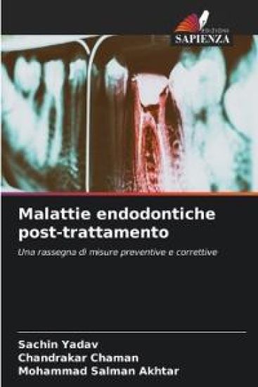 Malattie endodontiche post-trattamento – Sachin Yadav, kirjan kansikuva
