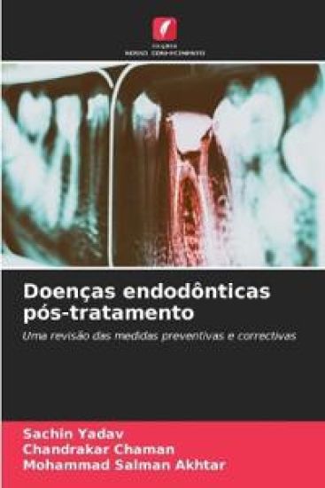 Doenças endodônticas pós-tratamento – Sachin Yadav, kirjan kansikuva