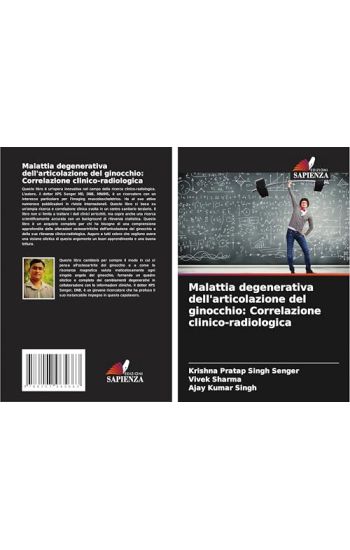 Malattia degenerativa dell'articolazione del ginocchio