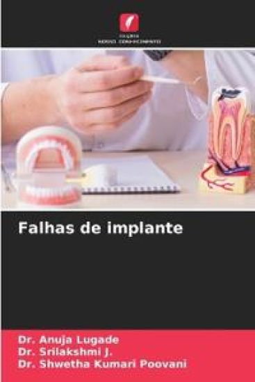 Falhas de implante